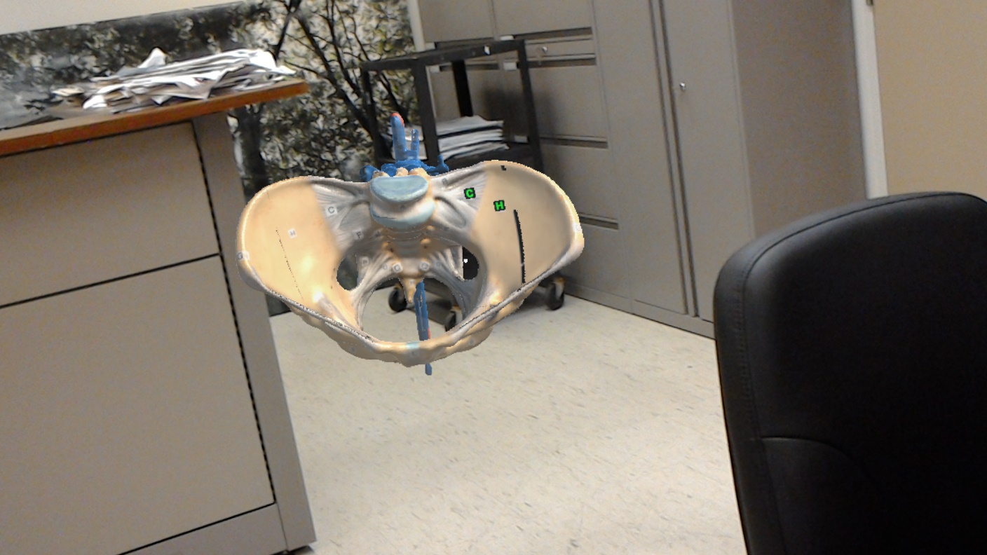 Screenshot of the HoloLens application